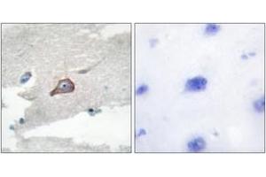Immunohistochemistry (IHC) image for anti-Hemopoietic Cell Kinase (HCK) (AA 381-430) antibody (ABIN2888843) (HCK anticorps  (AA 381-430))