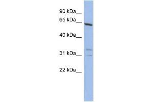 WB Suggested Anti-GTF2F1 Antibody Titration:  0. (GTF2F1 anticorps  (N-Term))