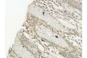ABIN6257469 and ABIN6274751 at 1/100 staining human normal gastric tissue by IHC-P. (RPS19 anticorps  (Internal Region))