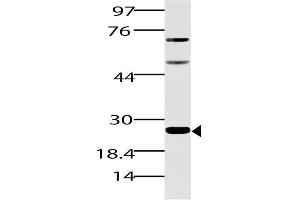 Image no. 1 for anti-Spi-B Transcription Factor (Spi-1/PU.1 Related) (SPIB) (AA 50-260) antibody (ABIN5027543) (SPIB anticorps  (AA 50-260))