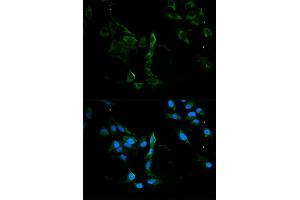 Immunofluorescence analysis of U2OS cells using MVP antibody. (MVP anticorps)