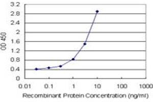 CETN1 (Human) Matched Antibody Pair