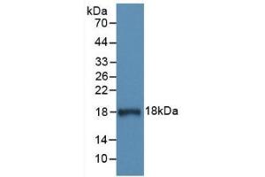 Detection of Recombinant C1INH, Human using Monoclonal Antibody to Complement 1 Inhibitor (C1INH)