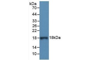 Detection of Recombinant C1INH, Human using Monoclonal Antibody to Complement 1 Inhibitor (C1INH) (SERPING1 anticorps  (AA 399-500))
