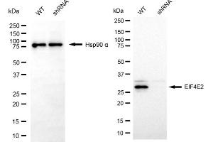 Western blotting analysis using EIF4E2 antibody (ABIN7798533).