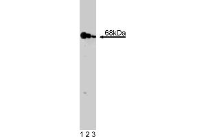 Western Blotting (WB) image for anti-Eukaryotic Translation Initiation Factor 2-alpha Kinase 2 (EIF2AK2) (AA 117-250) antibody (ABIN968165) (EIF2AK2 anticorps  (AA 117-250))