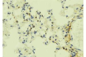 ABIN6273844 at 1/100 staining Mouse lung tissue by IHC-P.