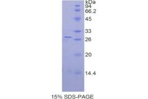SDS-PAGE of Protein Standard from the Kit (Highly purified E.