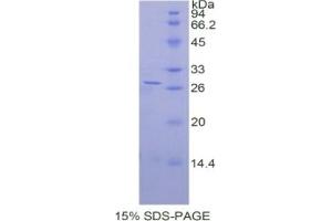 SDS-PAGE of Protein Standard from the Kit (Highly purified E. (ADRP Kit ELISA)