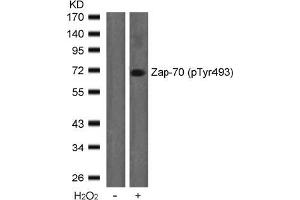 Image no. 2 for anti-zeta-Chain (TCR) Associated Protein Kinase 70kDa (ZAP70) (pTyr493) antibody (ABIN196886) (ZAP70 anticorps  (pTyr493))