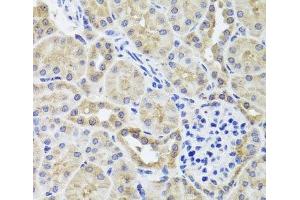 Immunohistochemistry of paraffin-embedded Mouse kidney using CGB7 Polyclonal Antibody at dilution of 1:100 (40x lens). (CGB7 anticorps)