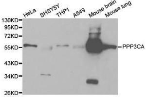 Western Blotting (WB) image for anti-Protein Phosphatase 3, Catalytic Subunit, alpha Isoform (PPP3CA) antibody (ABIN1874232) (PPP3CA anticorps)