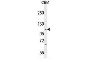 IFT88 Antibody