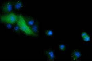 Image no. 3 for anti-Cancer/testis Antigen 1B (CTAG1B) antibody (ABIN1499891)