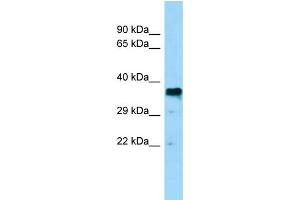 WB Suggested Anti-BSG Antibody Titration: 0. (CD147 anticorps  (Middle Region))