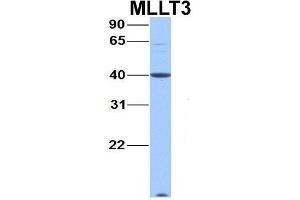 Host:  Rabbit  Target Name:  MLLT3  Sample Type:  Hela  Antibody Dilution:  1. (AF9 anticorps  (C-Term))