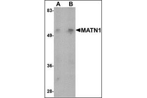 Western blot analysis of MATN1 in mouse liver tissue lysate with this product at (A) 1 and (B) 2 μg/ml. (MATN1 anticorps  (N-Term))