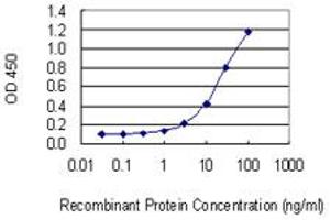 Detection limit for recombinant GST tagged SLC30A5 is 0. (SLC30A5 anticorps  (AA 1-118))