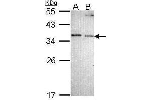 WB Image Sample (30 ug of whole cell lysate) A: A431 , B: H1299 12% SDS PAGE antibody diluted at 1:1000 (NOSIP anticorps)