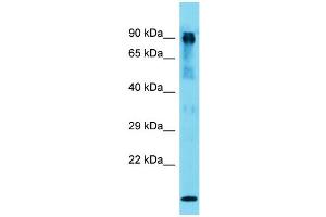 Host: Rabbit  Target Name: Mut  Sample Tissue: Mouse Muscle lysates  Antibody Dilution: 1. (MUT anticorps  (N-Term))