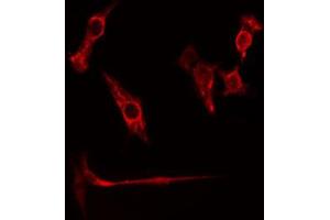 ABIN6274774 staining HuvEc cells by IF/ICC. (RPL26L1 anticorps  (C-Term))