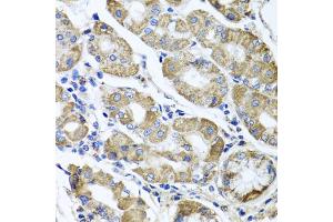 Immunohistochemistry of paraffin-embedded human stomach using ETFA antibody (ABIN5975750) at dilution of 1/100 (40x lens). (ETFA anticorps)