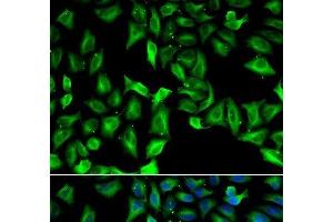 Immunofluorescence analysis of A549 cells using GDA Polyclonal Antibody (GDA anticorps)