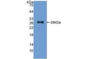 Western blot analysis of recombinant Human CDK9. (CDK9 anticorps  (AA 104-315))