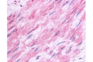 Anti-5HT1B Receptor antibody IHC of human vascular smooth muscle.