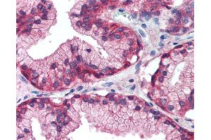 Anti-EGFR antibody IHC of human prostate. (EGFR anticorps  (Internal Region))