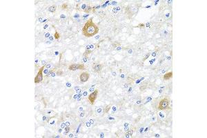 Immunohistochemistry of paraffin-embedded rat brain using NRG4 antibody at dilution of 1:100 (40x lens). (Neuregulin 4 anticorps)