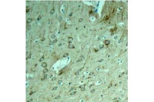 Image no. 1 for anti-Microtubule-Associated Protein tau (MAPT) (Thr231) antibody (ABIN197266)