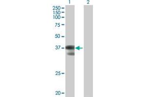 Western Blot analysis of C2orf3 expression in transfected 293T cell line by C2orf3 MaxPab polyclonal antibody. (GCFC2 anticorps  (AA 1-215))