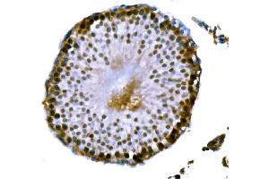 anti-DNA Meiotic Recombinase 1 (DMC1) (AA 36-283) antibody