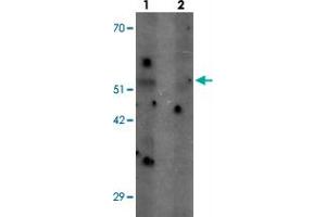 Western blot analysis of SHQ1 in human heart tissue with SHQ1 polyclonal antibody  at 1 ug/mL in (1) the absence and (2) the presence of blocking peptide.