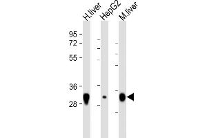 All lanes : Anti-TST Antibody (C-Term) at 1:8000 dilution Lane 1: human liver lysate Lane 2: HepG2 lysate Lane 3: mouse liver lysate Lysates/proteins at 20 μg per lane. (TST anticorps  (AA 208-232))
