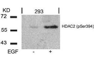 Image no. 3 for anti-Histone Deacetylase 2 (HDAC2) (pSer394) antibody (ABIN319237) (HDAC2 anticorps  (pSer394))