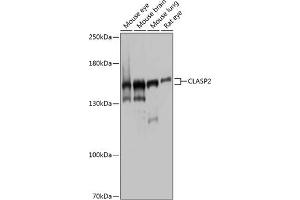 Western blot analysis of extracts of various cell lines, using CL antibody (ABIN1679249, ABIN3019015, ABIN3019016 and ABIN6220674) at 1:1000 dilution.