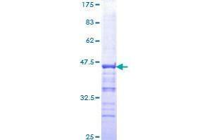 Image no. 1 for Pygopus Homolog 2 (PYGO2) (AA 1-110) protein (GST tag) (ABIN1316989)