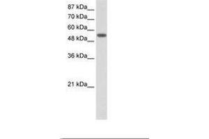 Image no. 1 for anti-Tyrosyl-tRNA Synthetase (Yars) (AA 451-500) antibody (ABIN202719) (YARS anticorps  (AA 451-500))