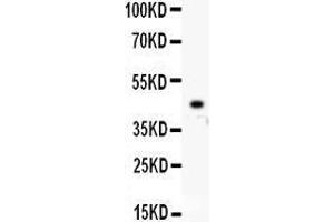 Western Blotting (WB) image for anti-Homeobox A10 (HOXA10) (AA 57-340) antibody (ABIN3042453) (HOXA10 anticorps  (AA 57-340))
