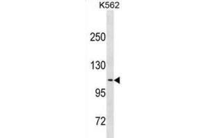 Western Blotting (WB) image for anti-Calsyntenin 2 (CLSTN2) antibody (ABIN3001117) (Calsyntenin 2 anticorps)