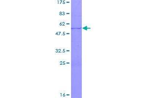 Image no. 1 for Synovial Sarcoma, X Breakpoint 4 (SSX4) (AA 1-188) protein (GST tag) (ABIN1321460)