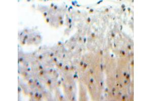 Used in DAB staining on fromalin fixed paraffin-embedded Brain tissue