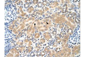 Immunohistochemistry (IHC) image for anti-Tetraspanin 5 (TSPAN5) (Middle Region) antibody (ABIN2782690)