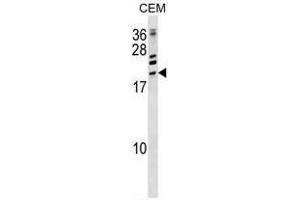 ATF3 Antibody (C-term) western blot analysis in CEM cell line lysates (35ug/lane). (ATF3 anticorps  (C-Term))