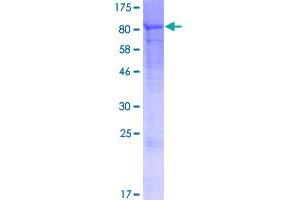 Image no. 1 for erythrocyte Membrane Protein Band 4.2 (EPB42) (AA 1-619) protein (GST tag) (ABIN1352892)
