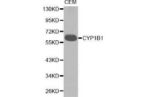Western blot analysis of extracts of CEM cell lines, using CYP1B1 antibody. (CYP1B1 anticorps  (AA 1-260))