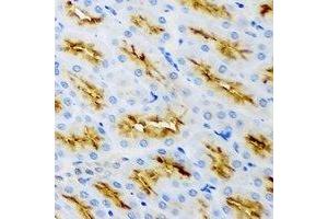 Immunohistochemical analysis of Clathrin Heavy Chain staining in rat kidney formalin fixed paraffin embedded tissue section. (Clathrin Heavy Chain (CLTC) anticorps)