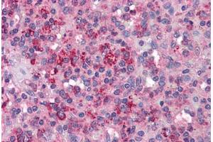 Human Spleen: Formalin-Fixed, Paraffin-Embedded (FFPE)